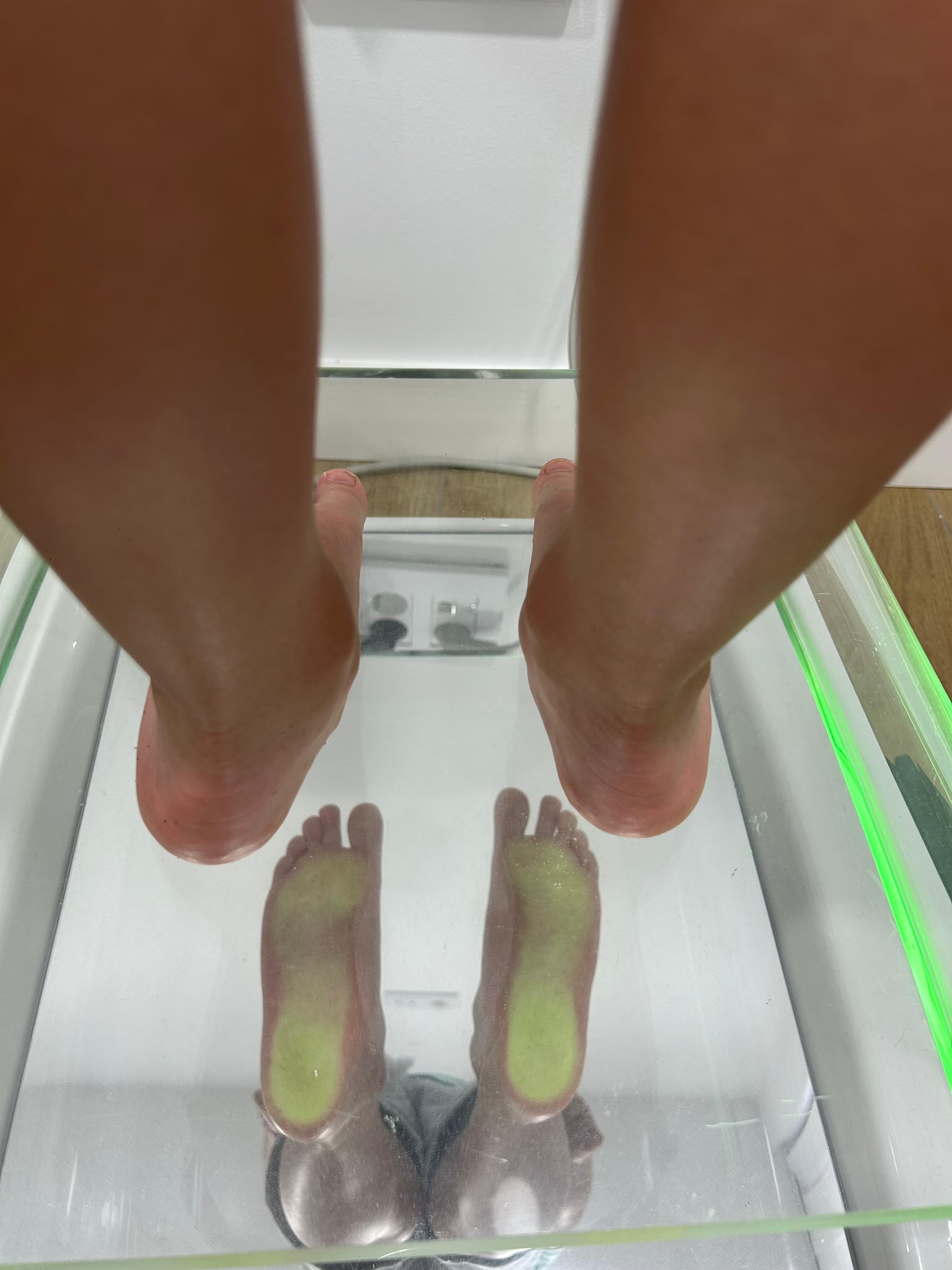 Estudio de la pisada con podoscopio en la clínica